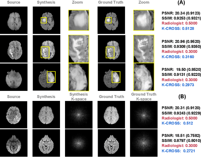 Figure 1 for K-Space-Aware Cross-Modality Score for Synthesized Neuroimage Quality Assessment