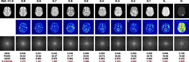 Figure 2 for K-Space-Aware Cross-Modality Score for Synthesized Neuroimage Quality Assessment