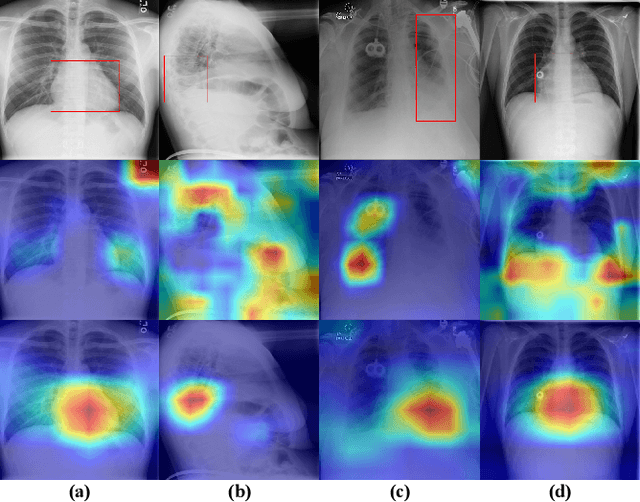Figure 1 for Chest X-ray Image Classification: A Causal Perspective