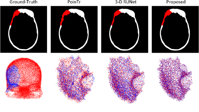 Figure 3 for High-Resolution Cranial Defect Reconstruction by Iterative, Low-Resolution, Point Cloud Completion Transformers