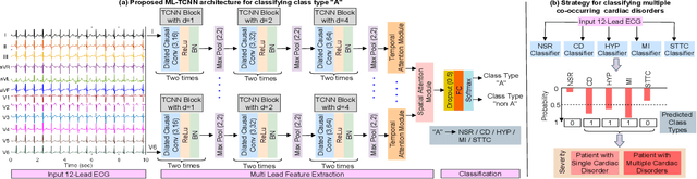 Figure 1 for Multi-Label ECG Classification using Temporal Convolutional Neural Network