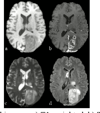 Figure 1 for 3D Inception-Based TransMorph: Pre- and Post-operative Multi-contrast MRI Registration in Brain Tumors