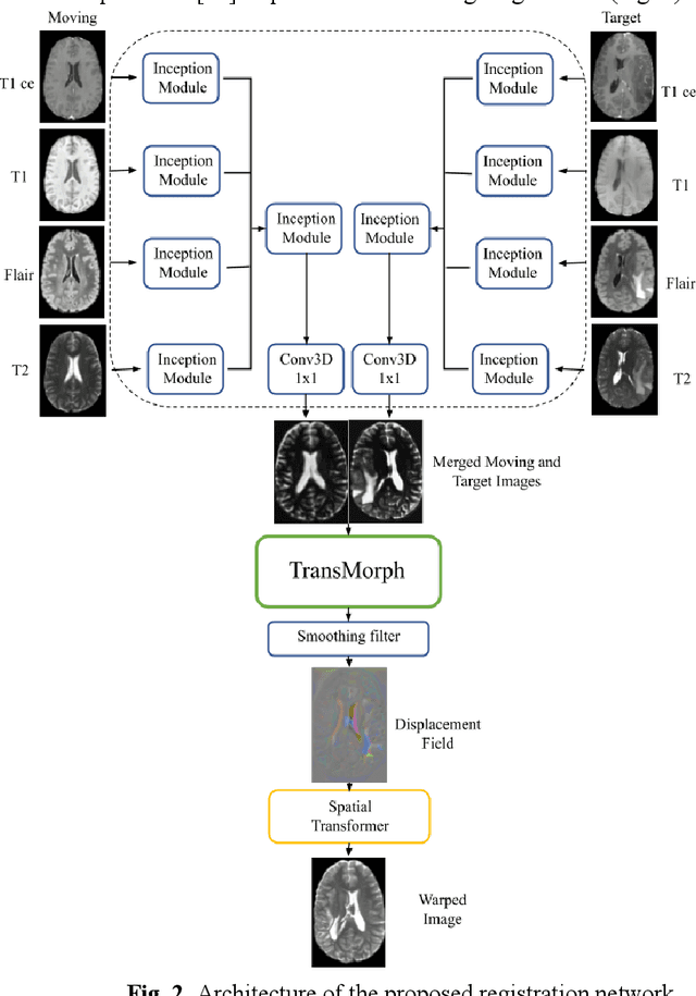 Figure 3 for 3D Inception-Based TransMorph: Pre- and Post-operative Multi-contrast MRI Registration in Brain Tumors