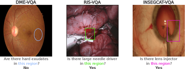 Figure 1 for Localized Questions in Medical Visual Question Answering