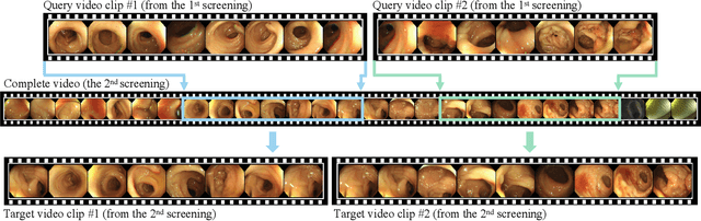 Figure 1 for Colo-SCRL: Self-Supervised Contrastive Representation Learning for Colonoscopic Video Retrieval