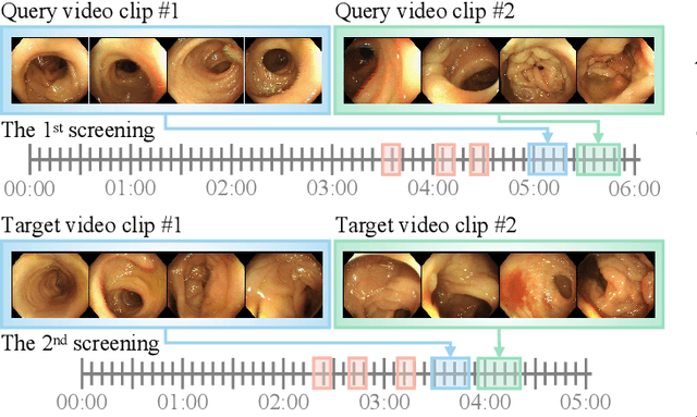Figure 2 for Colo-SCRL: Self-Supervised Contrastive Representation Learning for Colonoscopic Video Retrieval
