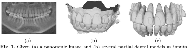 Figure 1 for ToothInpaintor: Tooth Inpainting from Partial 3D Dental Model and 2D Panoramic Image