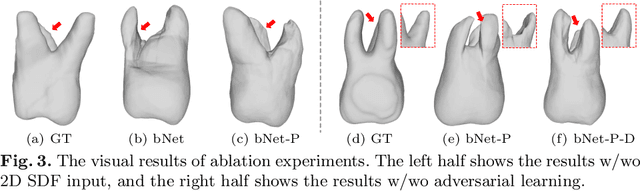 Figure 4 for ToothInpaintor: Tooth Inpainting from Partial 3D Dental Model and 2D Panoramic Image