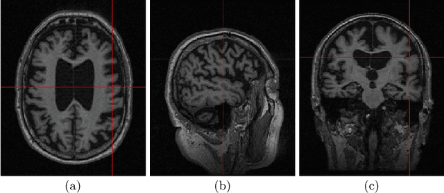 Figure 1 for Longitudinal Volumetric Study for the Progression of Alzheimer's Disease from Structural MR Images