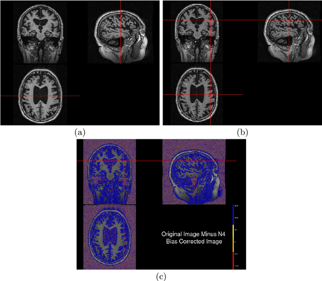 Figure 4 for Longitudinal Volumetric Study for the Progression of Alzheimer's Disease from Structural MR Images