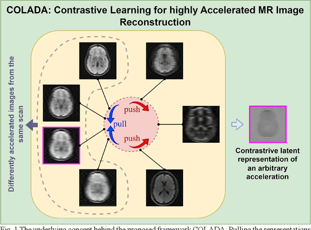 Figure 2 for Contrastive Learning MRI Reconstruction
