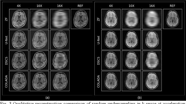 Figure 4 for Contrastive Learning MRI Reconstruction