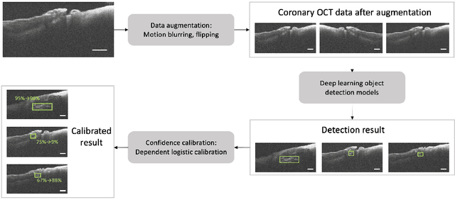 Figure 1 for Towards reliable calcification detection: calibration of uncertainty in coronary optical coherence tomography images