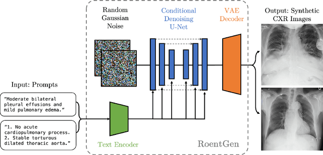 Figure 1 for RoentGen: Vision-Language Foundation Model for Chest X-ray Generation