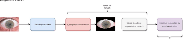 Figure 1 for A new eye segmentation method based on improved U2Net in TCM eye diagnosis