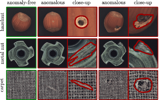 Figure 1 for Heuristic Hyperparameter Choice for Image Anomaly Detection