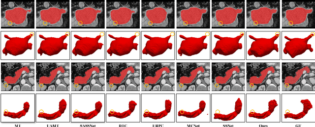 Figure 3 for Cross-supervised Dual Classifiers for Semi-supervised Medical Image Segmentation