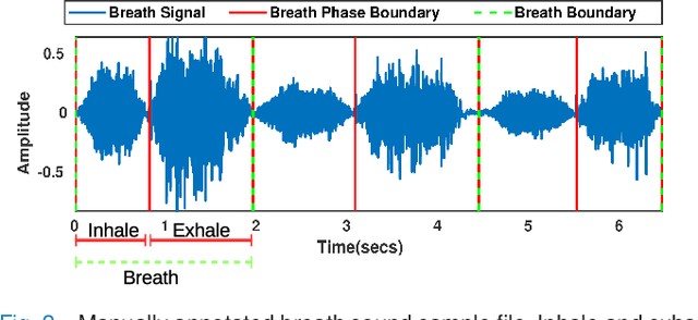 Figure 2 for An unsupervised segmentation of vocal breath sounds