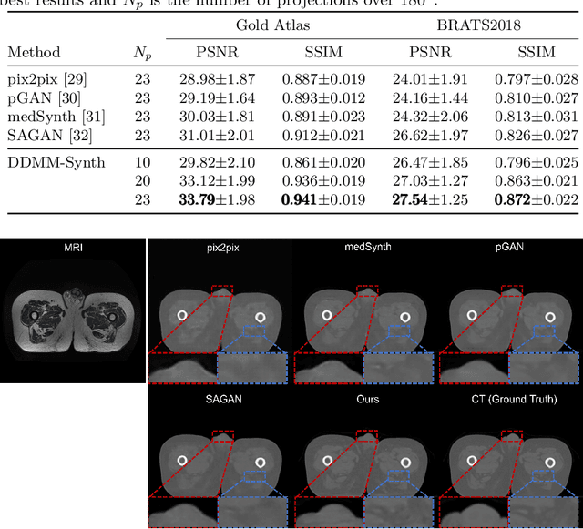 Figure 2 for DDMM-Synth: A Denoising Diffusion Model for Cross-modal Medical Image Synthesis with Sparse-view Measurement Embedding