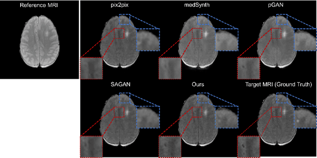 Figure 3 for DDMM-Synth: A Denoising Diffusion Model for Cross-modal Medical Image Synthesis with Sparse-view Measurement Embedding