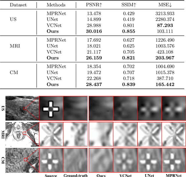 Figure 4 for Blind Inpainting with Object-aware Discrimination for Artificial Marker Removal