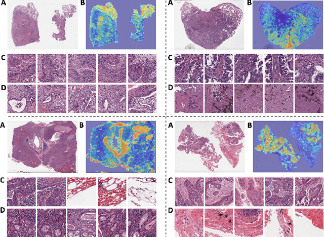 Figure 3 for Cascaded Cross-Attention Networks for Data-Efficient Whole-Slide Image Classification Using Transformers