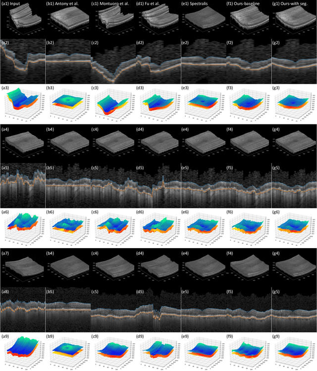 Figure 2 for Deep learning network to correct axial and coronal eye motion in 3D OCT retinal imaging