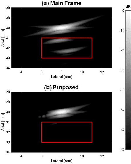 Figure 4 for Improved Row-Column-Addressed Array Imaging by Leveraging Ghost Echoes