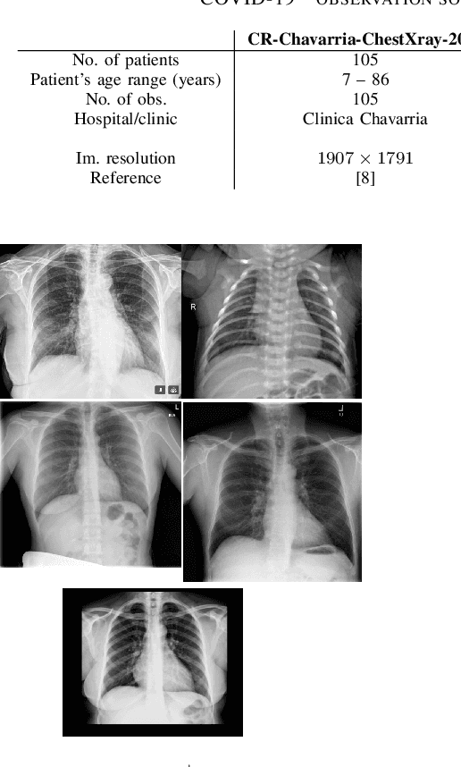 Figure 1 for Improving Semi-supervised Deep Learning by using Automatic Thresholding to Deal with Out of Distribution Data for COVID-19 Detection using Chest X-ray Images