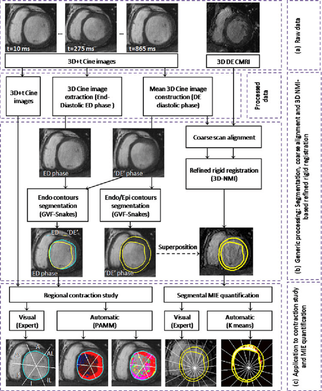 Figure 1 for Methodology for Jointly Assessing Myocardial Infarct Extent and Regional Contraction in 3-D CMRI