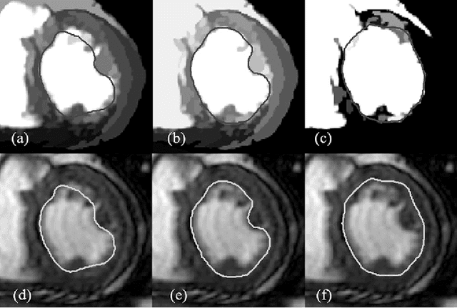 Figure 2 for Methodology for Jointly Assessing Myocardial Infarct Extent and Regional Contraction in 3-D CMRI