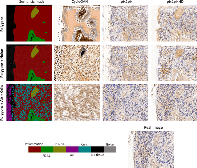 Figure 3 for Between Generating Noise and Generating Images: Noise in the Correct Frequency Improves the Quality of Synthetic Histopathology Images for Digital Pathology