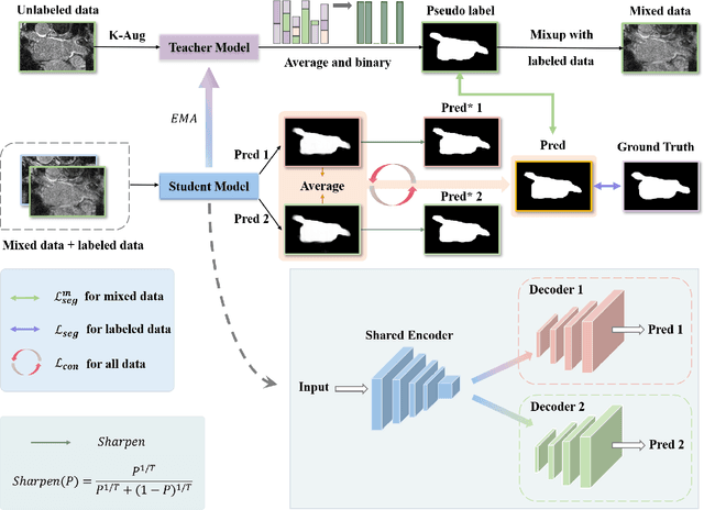 Figure 1 for Dual-Decoder Consistency via Pseudo-Labels Guided Data Augmentation for Semi-Supervised Medical Image Segmentation