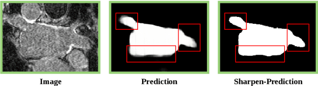 Figure 3 for Dual-Decoder Consistency via Pseudo-Labels Guided Data Augmentation for Semi-Supervised Medical Image Segmentation