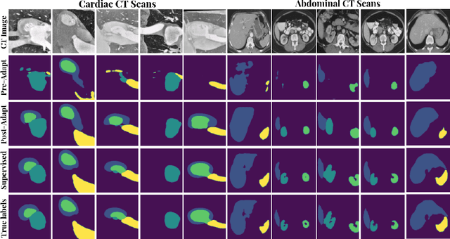 Figure 2 for Unsupervised Model Adaptation for Source-free Segmentation of Medical Images