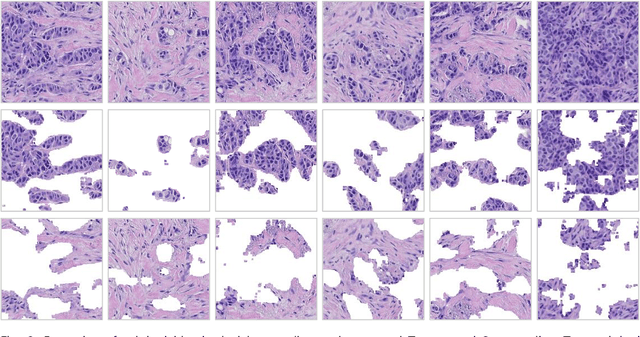 Figure 3 for Experts' cognition-driven ensemble deep learning for external validation of predicting pathological complete response to neoadjuvant chemotherapy from histological images in breast cancer