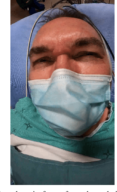 Figure 1 for Pain Detection in Masked Faces during Procedural Sedation