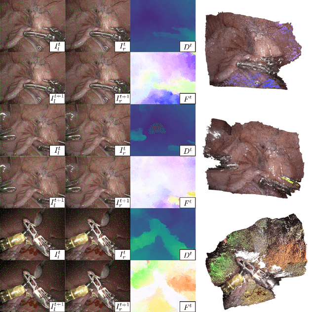 Figure 1 for SENDD: Sparse Efficient Neural Depth and Deformation for Tissue Tracking