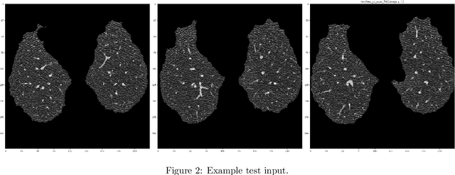 Figure 4 for Severity classification of ground-glass opacity via 2-D convolutional neural network and lung CT scans: a 3-day exploration