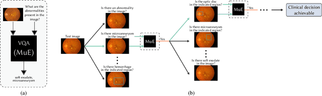 Figure 1 for A reinforcement learning approach for VQA validation: an application to diabetic macular edema grading