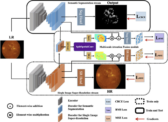 Figure 2 for Hard Exudate Segmentation Supplemented by Super-Resolution with Multi-scale Attention Fusion Module
