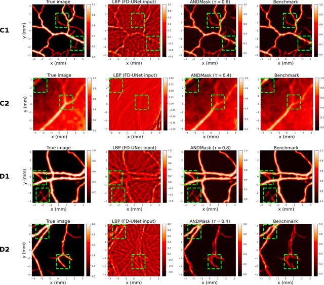 Figure 3 for Invariant Representations in Deep Learning for Optoacoustic Imaging