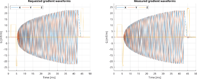 Figure 4 for Open-source Pulseq sequences on Philips MRI scanners