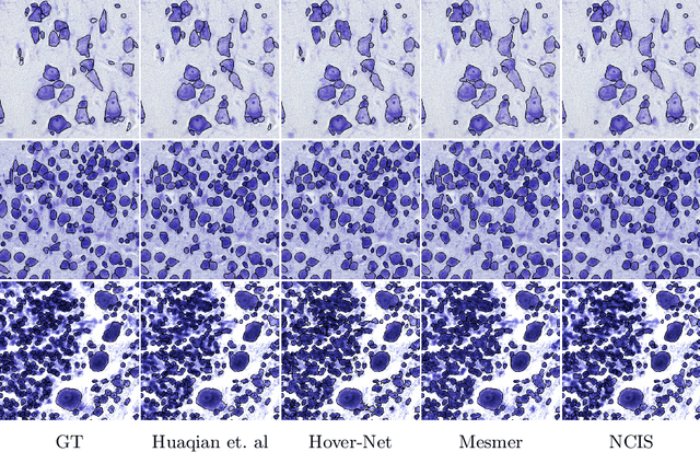 Figure 4 for NCIS: Deep Color Gradient Maps Regression and Three-Class Pixel Classification for Enhanced Neuronal Cell Instance Segmentation in Nissl-Stained Histological Images