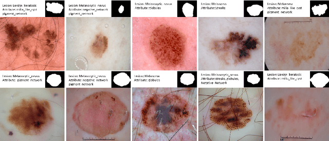 Figure 1 for Boosting Dermatoscopic Lesion Segmentation via Diffusion Models with Visual and Textual Prompts