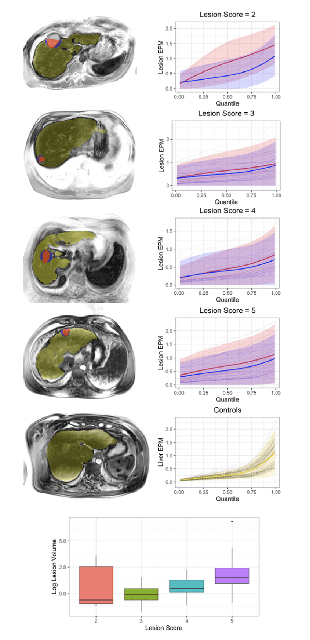 Figure 3 for Heterogeneous Image-based Classification Using Distributional Data Analysis