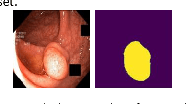 Figure 3 for Multi Kernel Positional Embedding ConvNeXt for Polyp Segmentation