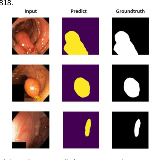 Figure 4 for Multi Kernel Positional Embedding ConvNeXt for Polyp Segmentation