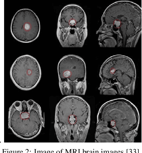 Figure 3 for Case Studies on X-Ray Imaging, MRI and Nuclear Imaging