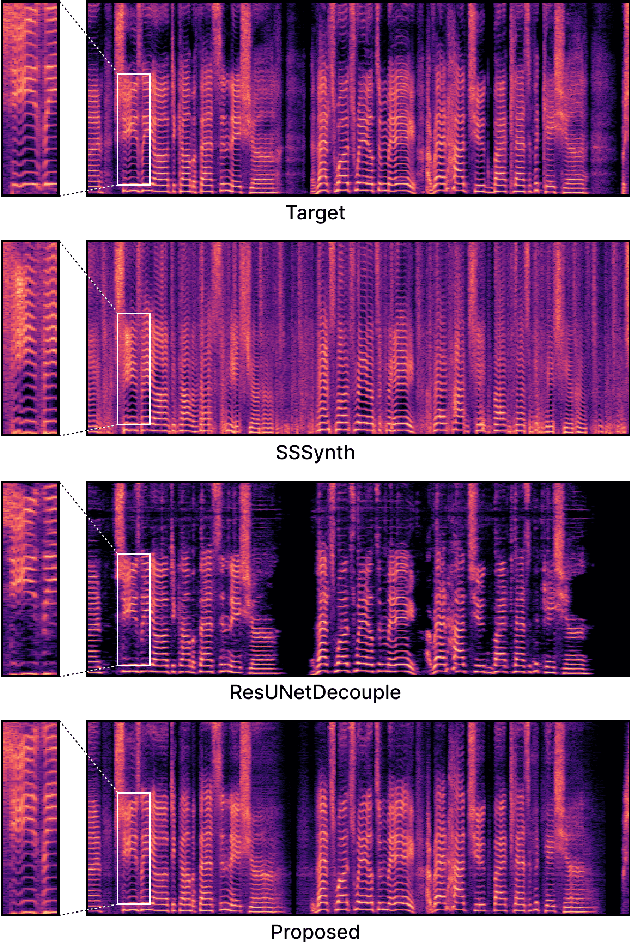 Figure 4 for Neural Vocoder Feature Estimation for Dry Singing Voice Separation
